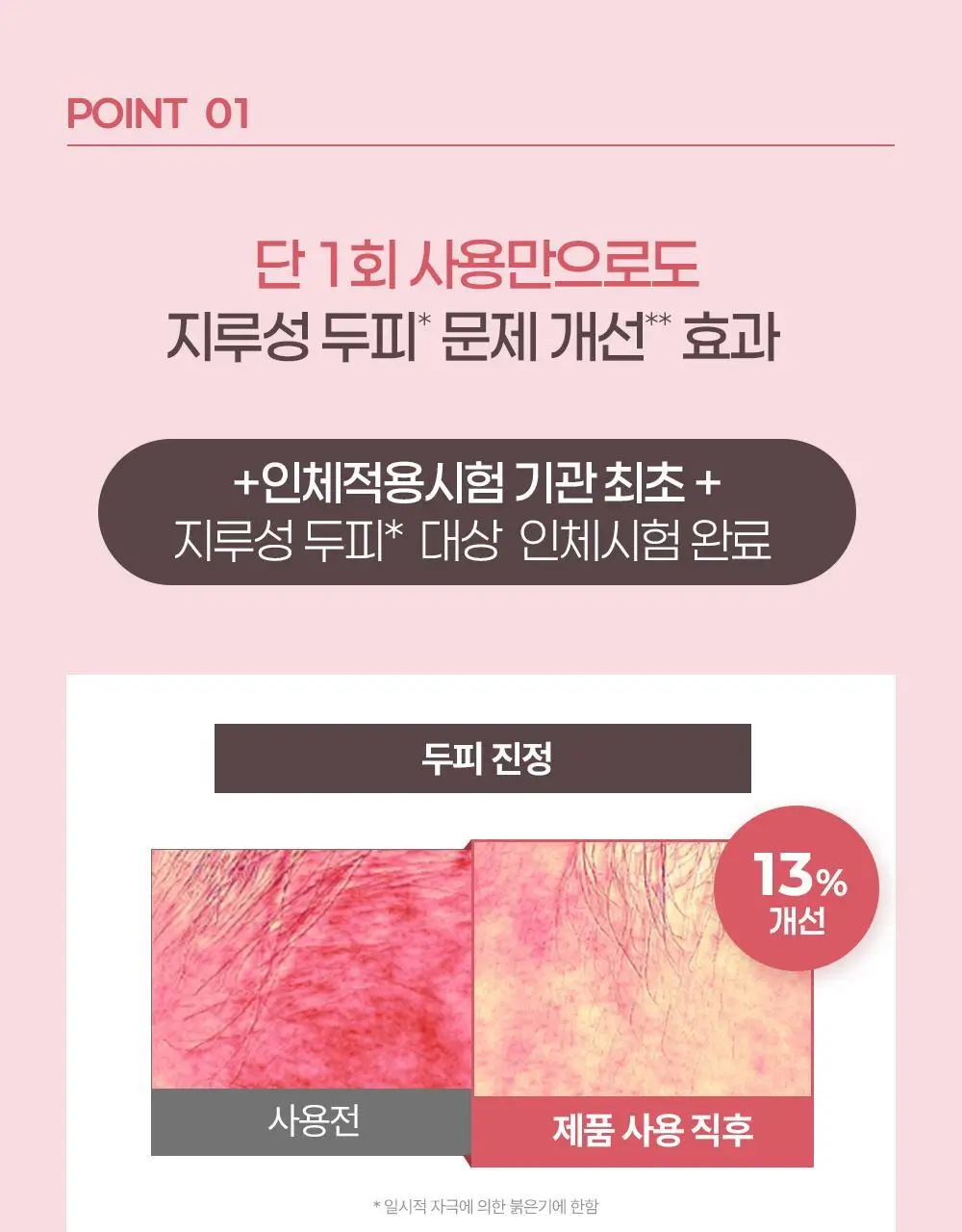 [두피 붉은기 개선 스팟젤] 닥터그루트 클리니컬 릴리프 지루성두피용 스팟 젤 80ml 상세페이지 10